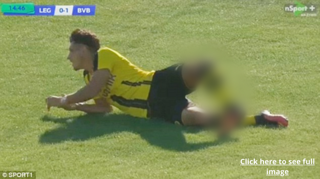 15 Knee Injury Real Images